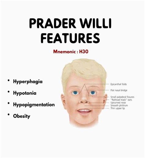 Prader–willi Syndrome Features Medizzy