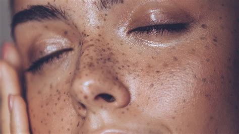 What Causes Oily Skin 9 Reasons Your Skin Is So Oily L’oréal Paris