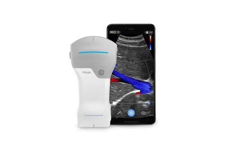 Ge Healthcare Launches Handheld Ultrasound Massdevice