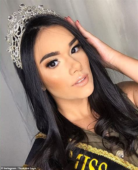 Brazilian Beauty Queen 21 Dies During Surgery To Remove A Tumor Near
