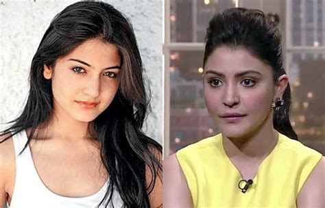 bollywood actresses plastic surgery  wrong    pictures
