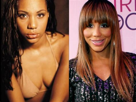 Tamar Braxton Before And After Plastic Surgery 05 Celebrity Plastic