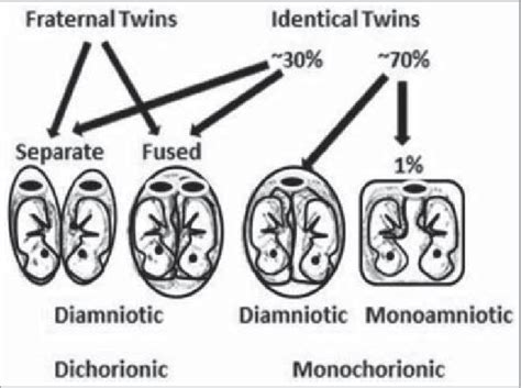 Identical Twins Vs Fraternal Twins Hiccups Pregnancy