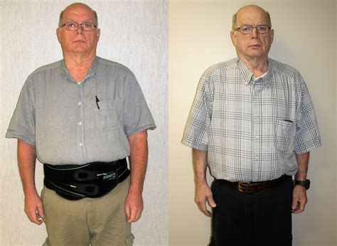 Richard S Weight Loss Transformation St Louis Bariatrics