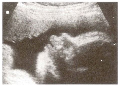 Sexual intercourse ultrasound