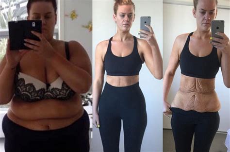 Woman Shamed For 194 Pound Weight Loss Shows Off Body