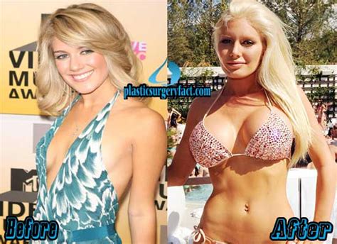 Sexy boob jobs