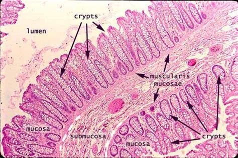 large intestine pathology pinterest