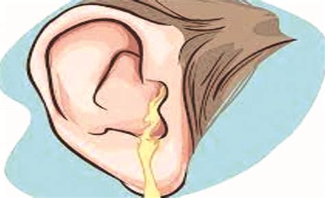 gejala   penanganan infeksi telinga wwwindoposcoid