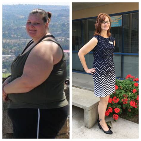 Pin On Weight Loss Surgery Before And After Transformation Success Pictures