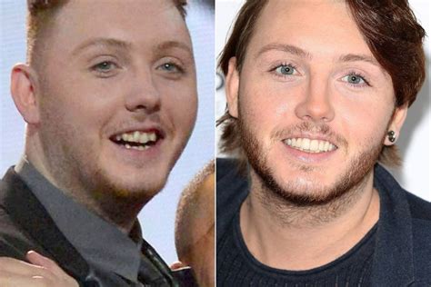celebrity teeth   teeth whitening makeovers pictures