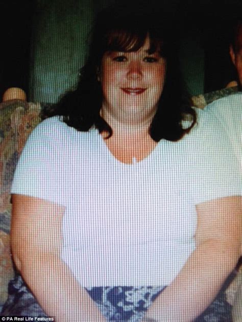 Obese Nurse Karen Smith Spends £20 000 To Get Her Sex Life Back Daily