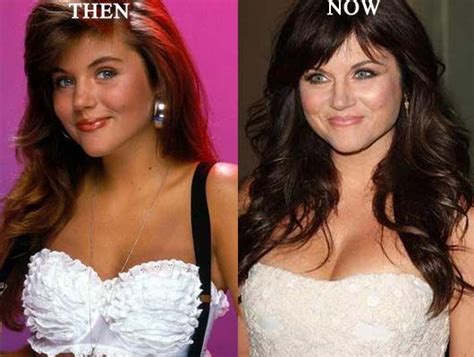 Tiffani Thiessen Plasticsurgery Photo Before And After