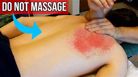 7 must know contraindications of massage therapy youtube