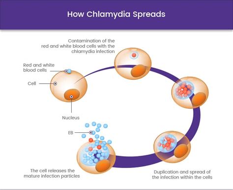ᐅ Buy Chlamydia Treatment Online With Further Information Available
