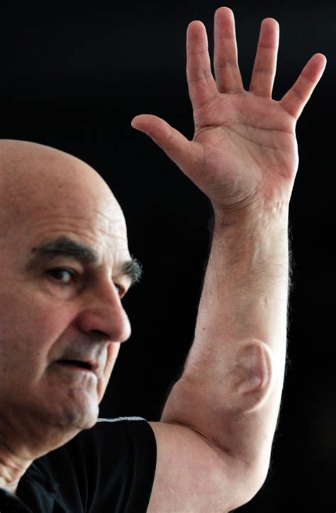 eccentric australian artist grows extra ear on his arm