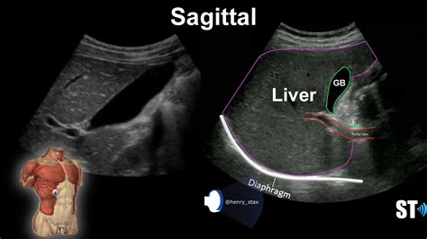 liver anatomy  protocol sonographic tendencies