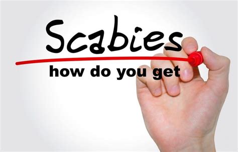 how do you get scabies causes symptoms treatment pictures
