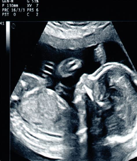 medicina materno fetal perinatal genesis centro de fertilidad