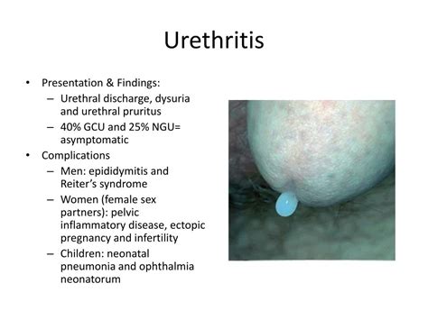 Ppt Urethritis Powerpoint Presentation Free Download Id 3093350