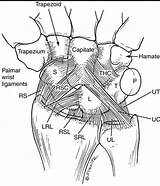 Wrist Ligaments Extrinsic Scaphoid Tfcc Hand Navicular Tfc Ligament Intrinsic Testut Joints Triangular Fibrocartilage Biomechanics Orthobullets Injuries Sprains Lunate Translocation sketch template