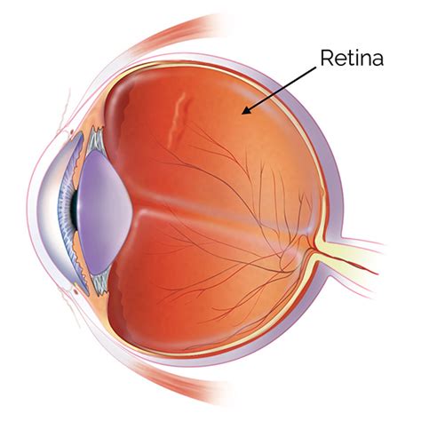 retina  johns hopkins patient guide  diabetes