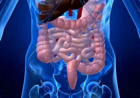 medical community shouldnt  confounded   surge  inflammatory bowel disease