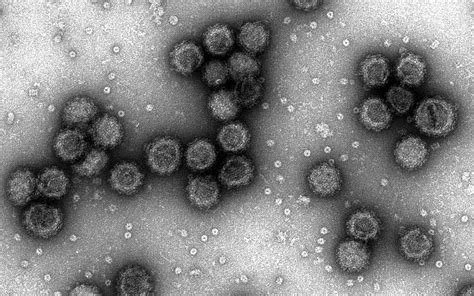 tem images   virus  particles  native antigen company