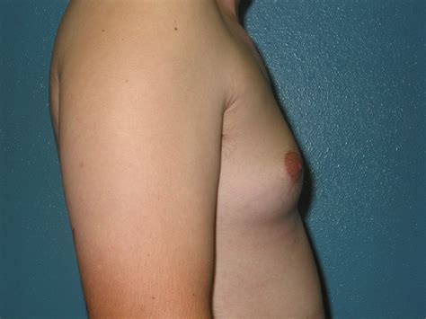 puberty budding breasts image 4 fap