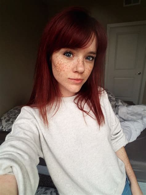 okay this one has freckles r freckledgirls