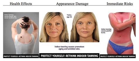 Tanning Bed Can Ruin Your Life As Sunbed Risks Are High Causing Skin