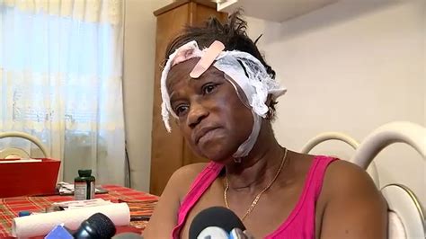 71 Year Old Prospect Lefferts Gardens Woman Sucker Punched In Random