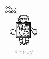 Xray Radiology Coloringhome sketch template