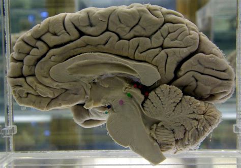 brain disease types symptoms   treatment  news