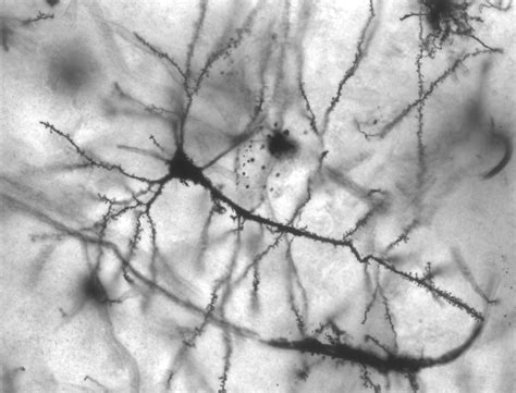 dendritic spines  memory
