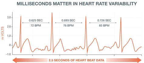 milliseconds make the difference in heart health biotricity