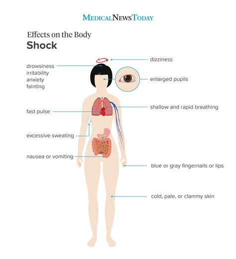 shock signs symptoms