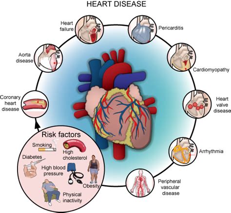heart disease risk factors cardiovascular disease
