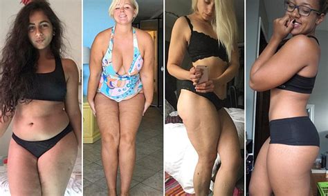 women share photos of cellulite on instagram for new body