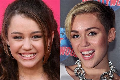 25 celebrities who thankfully have had dental work