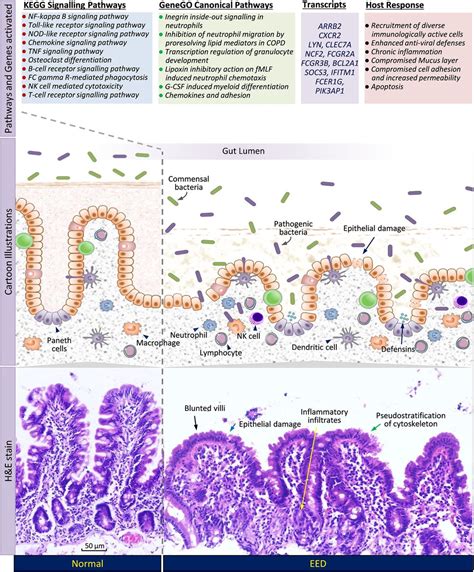 New Insights Into Environmental Enteric Dysfunction Archives Of