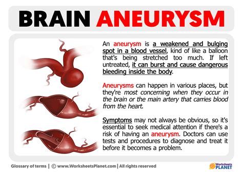 aneurysm definition  aneurysm