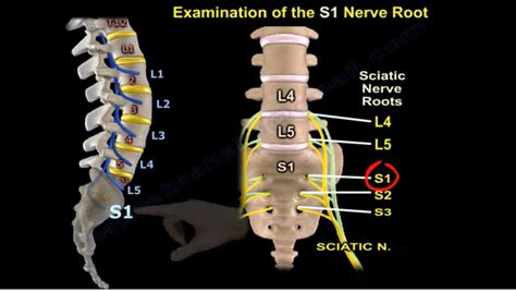 examination   nerve root orthopaedicprinciplescom