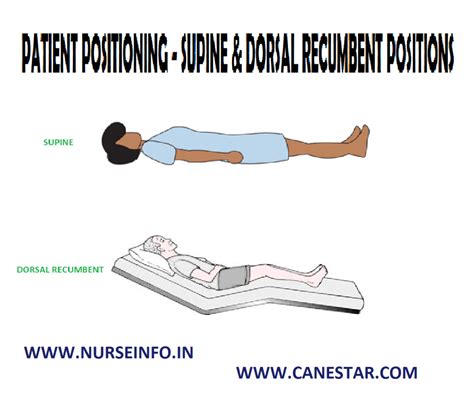 patient positioning supine dorsal recumbent position nurse info