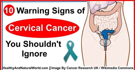 10 Warning Signs Of Cervical Cancer You Shouldn T Ignore