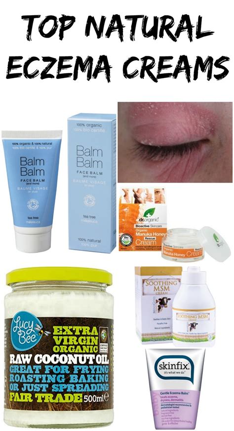 top  natural eczema creams  sensitive skin lux life london  luxury lifestyle blog