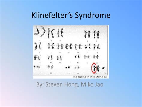 Ppt Klinefelters Syndrome Powerpoint Presentation Free Download