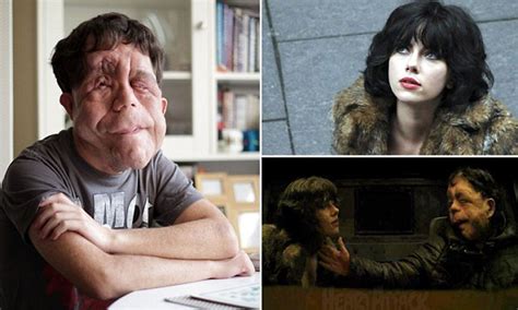 Adam Pearson Hopes To Beat Prejudice After Under The Skin