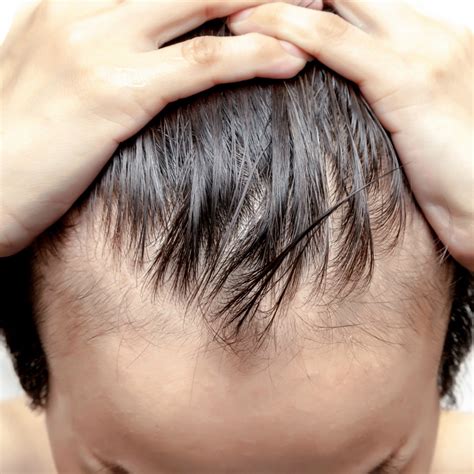 stimulating stem cells  encourage hair growth worldhealthnet anti aging news