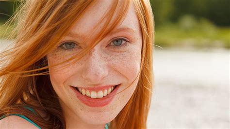 that gene for your cute freckles and red hair could be aging you health